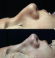 Slider image (10) Dr. Juan Sanabria Plastic Surgeon